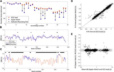 Cardiac sensing at a spinal cord stimulation lead: a promising on-device potential biomarker for pain and wellbeing